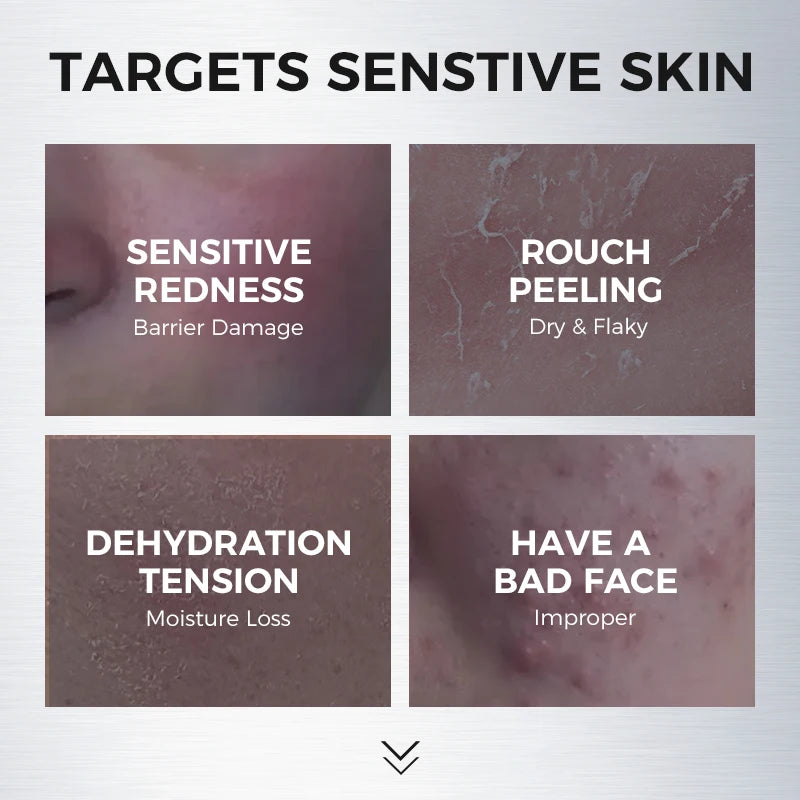 150ML Amino Acid Cleansing Foam for Sensitive Skin: Hydrating, Non-Tightening, Gentle & Low-Irritation with Dense Foam